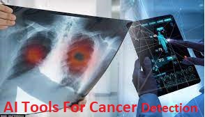 New Artificial Intelligence Can Accurately Identify Cancer In 2023