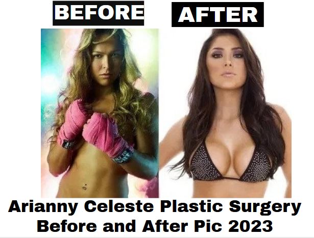 Arianny Celeste Plastic Surgery Before and After Pic 2023