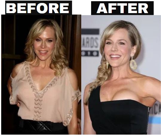 Julie Benz Breast Reduction Surgery 2023: Before and After Transformation