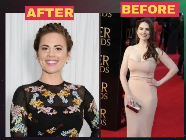 Did Hayley Atwell Get A Breast Reduction?