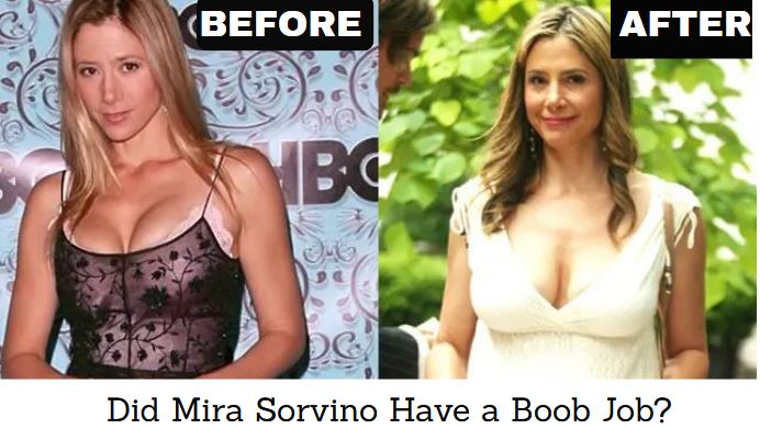 Did Mira Sorvino Have a Boob Job?