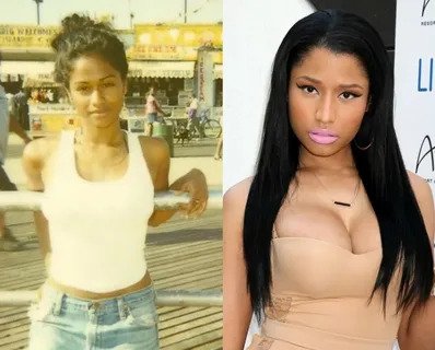 Did Nicki Minaj Get Breast Implants?